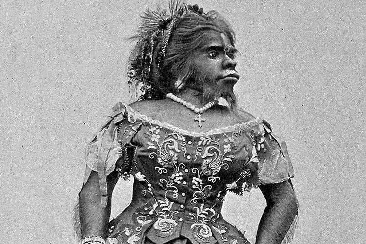 世界最丑的女人是谁（1.38米浑身长毛，死后被丈夫制成标本展览153年）
