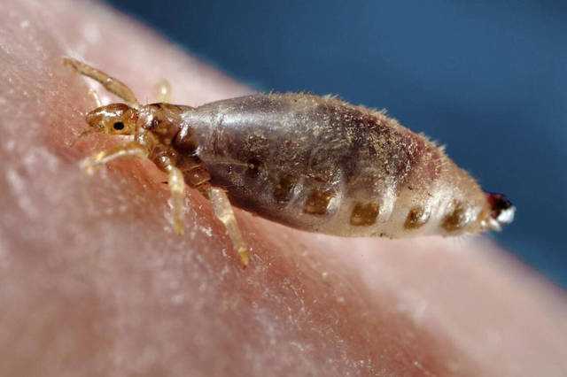 虱子有何危害？几十年前人人身上都有的虱子，为何现在看不到了？